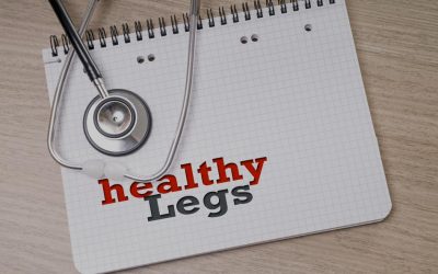 Why You Should Get Rid of Your Varicose Veins Now – Stop Procrastinating