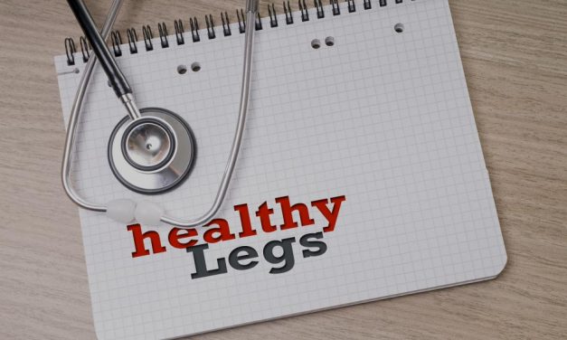 Why You Should Get Rid of Your Varicose Veins Now – Stop Procrastinating