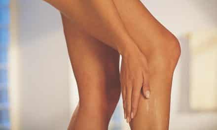 Seriously – Always Get a Second Opinion for Your Varicose Veins