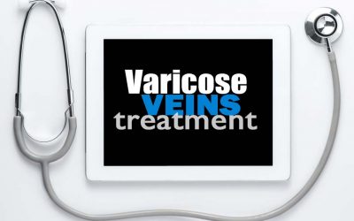 5 Practical Tips to Find the Best Vein Treatment Center in Pittsburgh