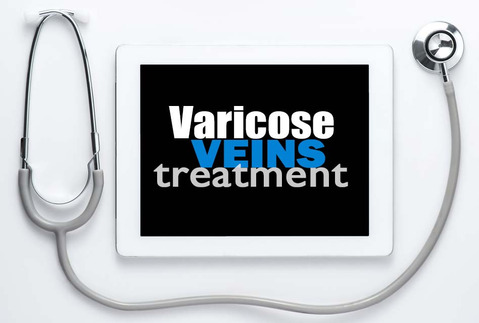 varicose vein treatment Pittsburgh